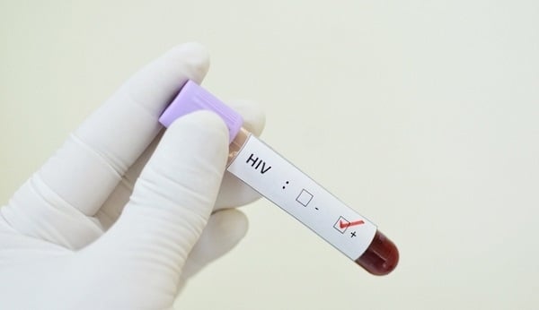 De acordo com o trabalho, entre 2000 e 2016, o número de adultos com 50 anos ou mais vivendo com HIV na África Subsaariana dobrou.
