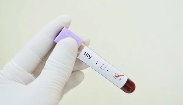 Ele é um dos seis transplantados que se infectaram com o vírus causador da Aids após um erro laboratorial não ter acusado a presença do HIV nos órgãos.