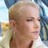 Descubra mais sobre a alopecia androgenética e seus sintomas. Conheça o relato da apresentadora Xuxa Meneghel e entenda melhor essa condição.