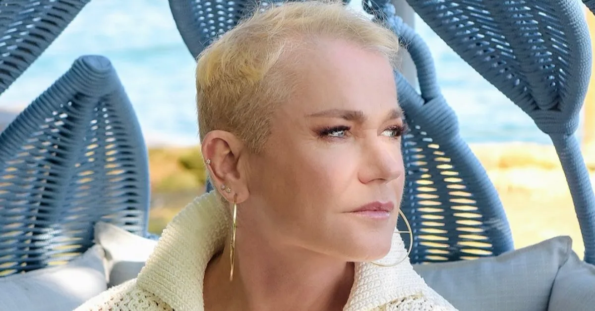 Descubra mais sobre a alopecia androgenética e seus sintomas. Conheça o relato da apresentadora Xuxa Meneghel e entenda melhor essa condição.