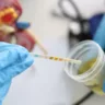 Como teste de urina pode ajudar a detectar câncer de próstata