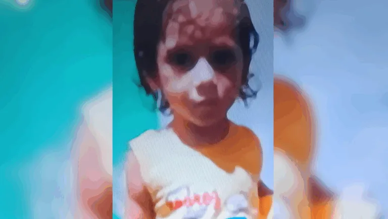 Um trágico acidente resultou na morte do pequeno Guilherme Souza dos Santos, de apenas 4 anos, em Ananindeua, na Região Metropolitana de Belém.