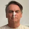 O ex-presidente Jair Bolsonaro (PL) recebeu alta do Hospital DF Star, em Brasília, neste domingo (4), onde estava internado havia três semanas