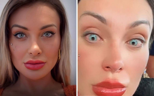 Andressa Urach sofre complicações após mudar cor dos olhos na França
