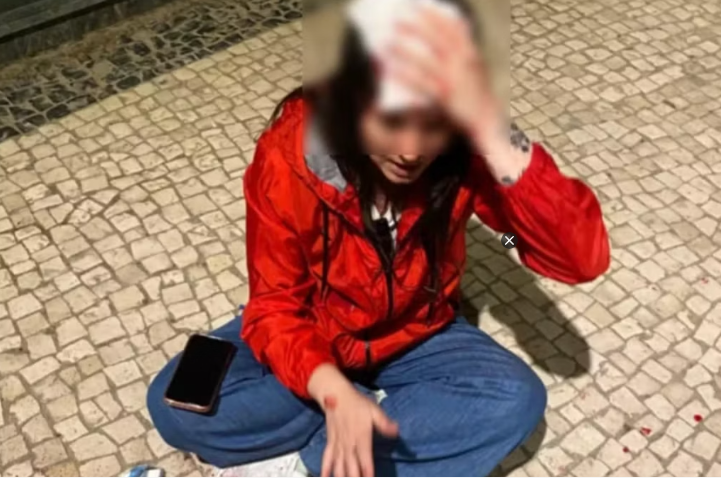 Uma mulher brasileira diz ter sido atingida na cabeça por uma pedra arremessada de uma janela na cidade do Porto, em Portugal.