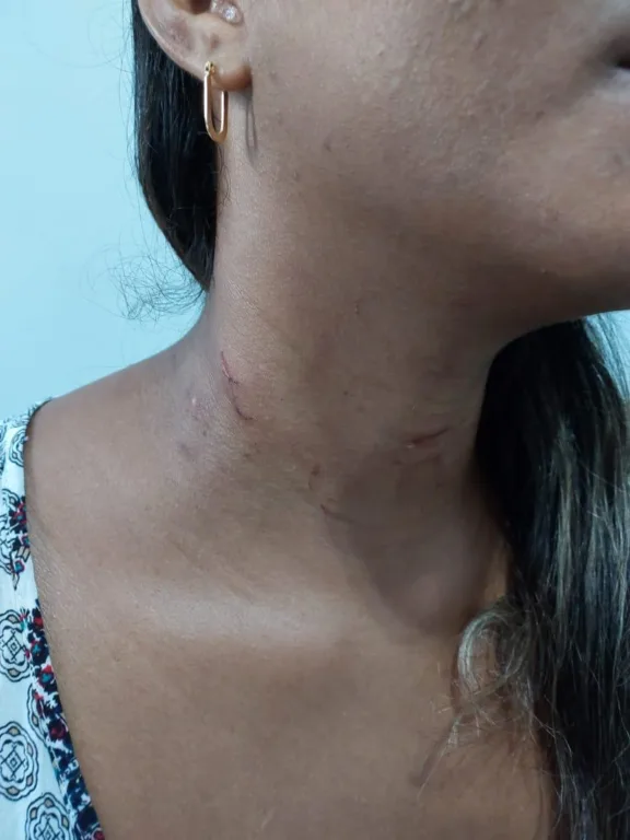 Com marcas pelo corpo e um forte hematoma no rosto, a vítima relatou detalhes da agressão.