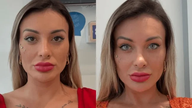 Andressa Urach muda a cor dos olhos com cirurgia na Itália
