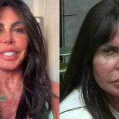 Gretchen voltou a surpreender os fãs ao revelar o resultado de sua nova harmonização facial nesta terça-feira (29).