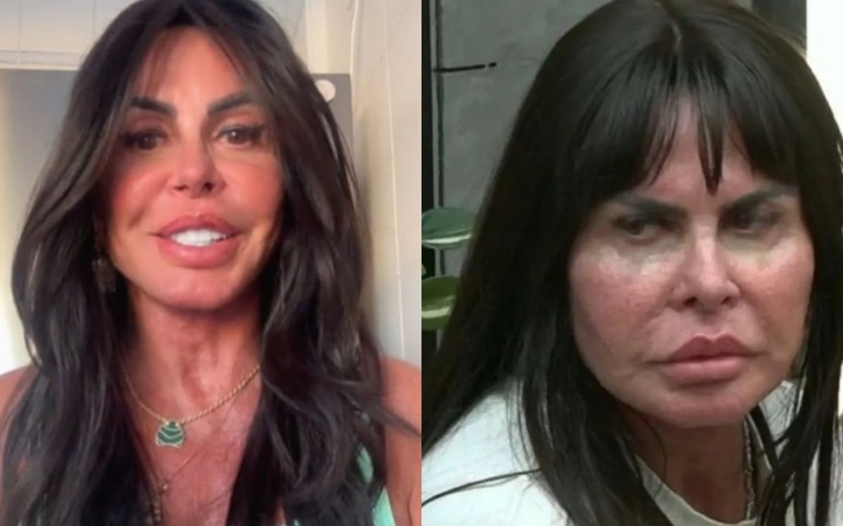 Gretchen voltou a surpreender os fãs ao revelar o resultado de sua nova harmonização facial nesta terça-feira (29).