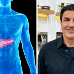 Entenda o câncer de pâncreas, que afeta o apresentador Edu Guedes