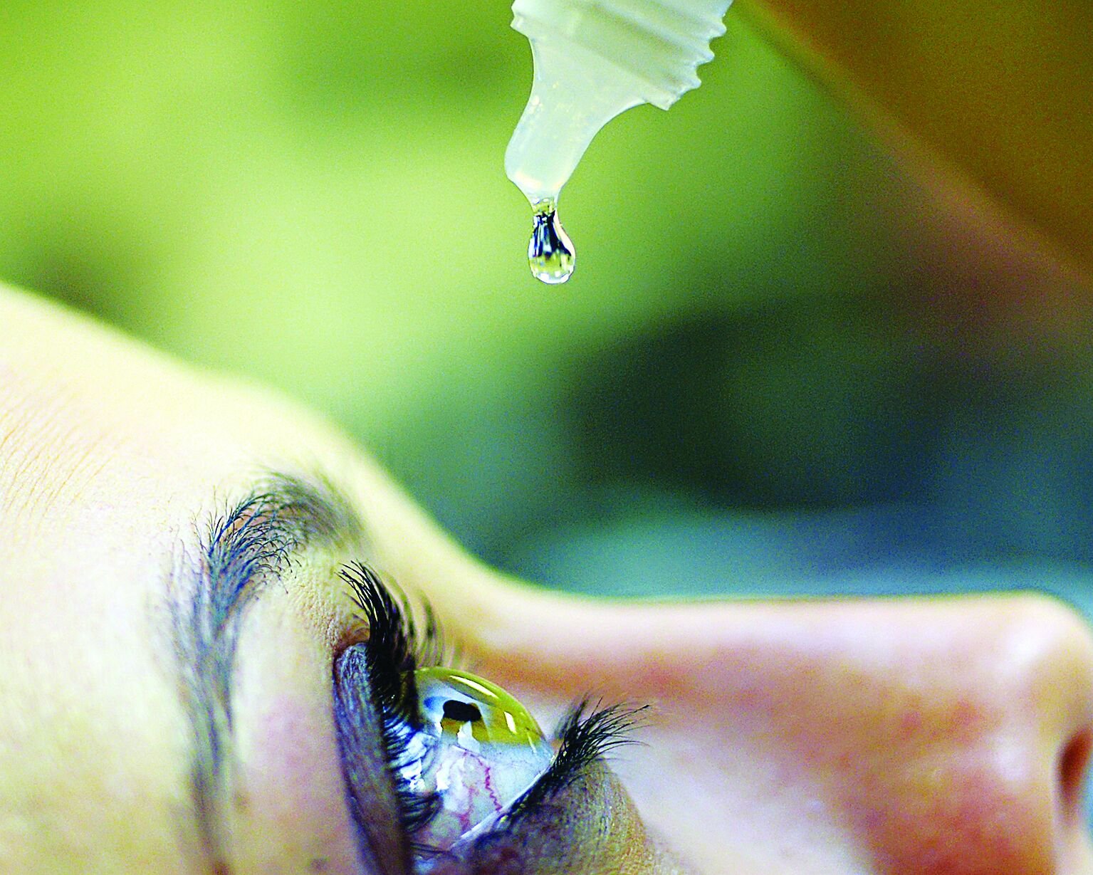 Segundo a OMS, cerca de 2 bilhões de pessoas no mundo sofrem de algum problema ocular

FOTO: MARCELLO CASAL JR / AGÊNCIA BRASIL