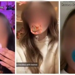 Uma inusitada tendência tem ganhado espaço nas redes sociais e preocupado profissionais de saúde: o uso de chupetas por adultos.