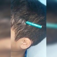Menino de 9 anos é hospitalizado após colega cravar lápis em sua cabeça dentro de escola em SP