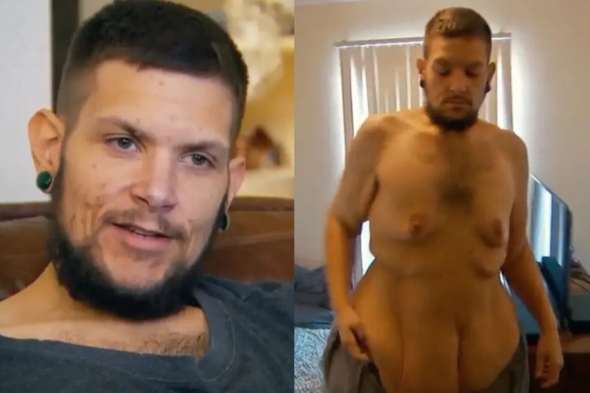 Com ajuda do Dr. Now, J.T. elimina mais de 180 kg e retoma a vida