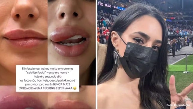 Reprodução