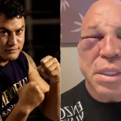 Após briga, Wanderlei Silva e Popó enfrentam recuperação com ferimentos distintos