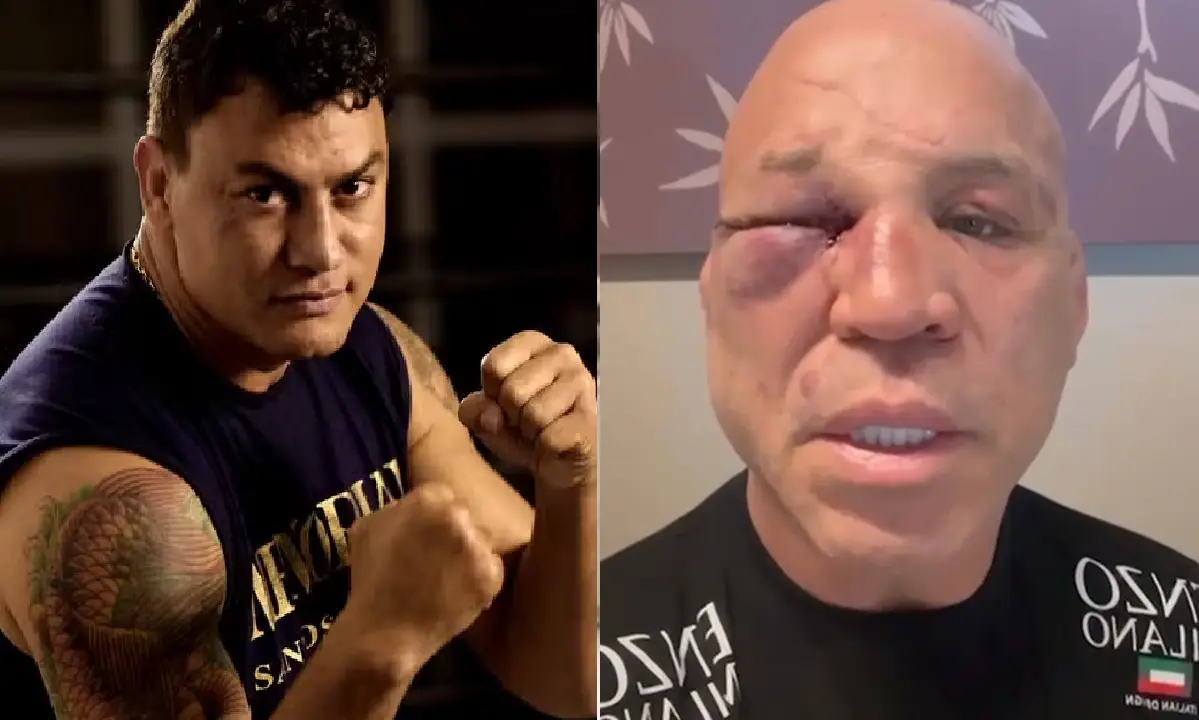 Após briga, Wanderlei Silva e Popó enfrentam recuperação com ferimentos distintos