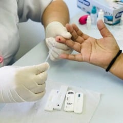 Ação terá realização de testes rápidos para HIV, sífilis e hepatites B e C. Foto: Divulgação