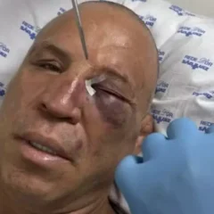 Wanderlei Silva é nocauteado em briga generalizada e fratura nariz