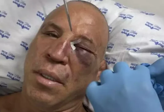 Wanderlei Silva é nocauteado em briga generalizada e fratura nariz