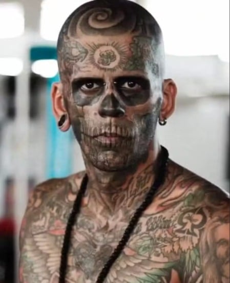 O procedimento é uma novidade no Brasil e foi realizado pelo biomédico Giancarlo Pincelli, dono da clínica responsável pela remoção das tatuagens de Leandro.