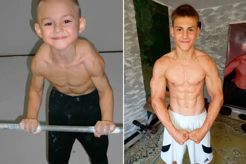  Giuliano Stroe antes e depois. Foto: Divulgação