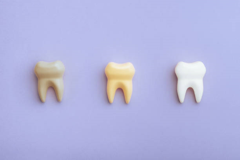 Mitos e verdades sobre alimentos que mancham os dentes Mitos e verdades sobre alimentos que mancham os dentes