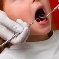 Saiba qual o melhor momento para levar a criança ao dentista. Foto: Freepik