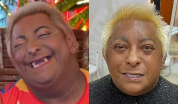 Influenciadora comemorou novos dentes. Foto: Reprodução/Redes sociais