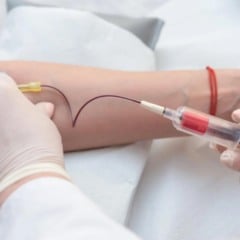 Exame brasileiro identifica Alzheimer com até 90% de precisão