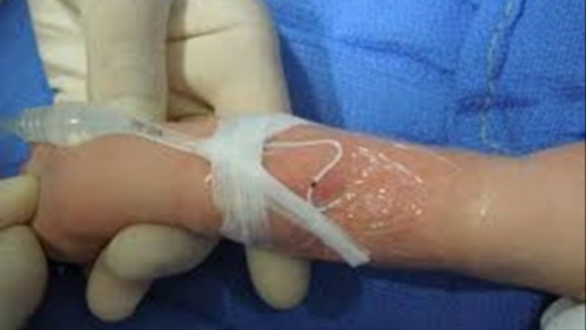 Incidentes evitáveis seguem ameaçando recém-nascidos: estudo revela dados preocupantes