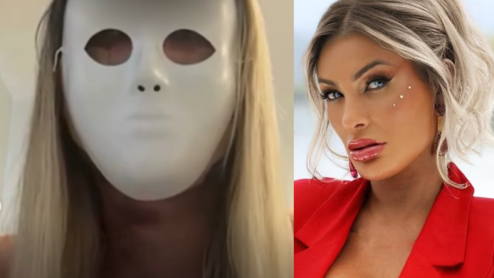 Andressa Urach faz cirurgia de R$ 100 mil para mudar o rosto