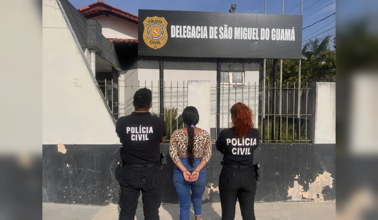 Bebê de 6 meses sofre queimaduras em 30% do corpo no Pará e mãe é presa