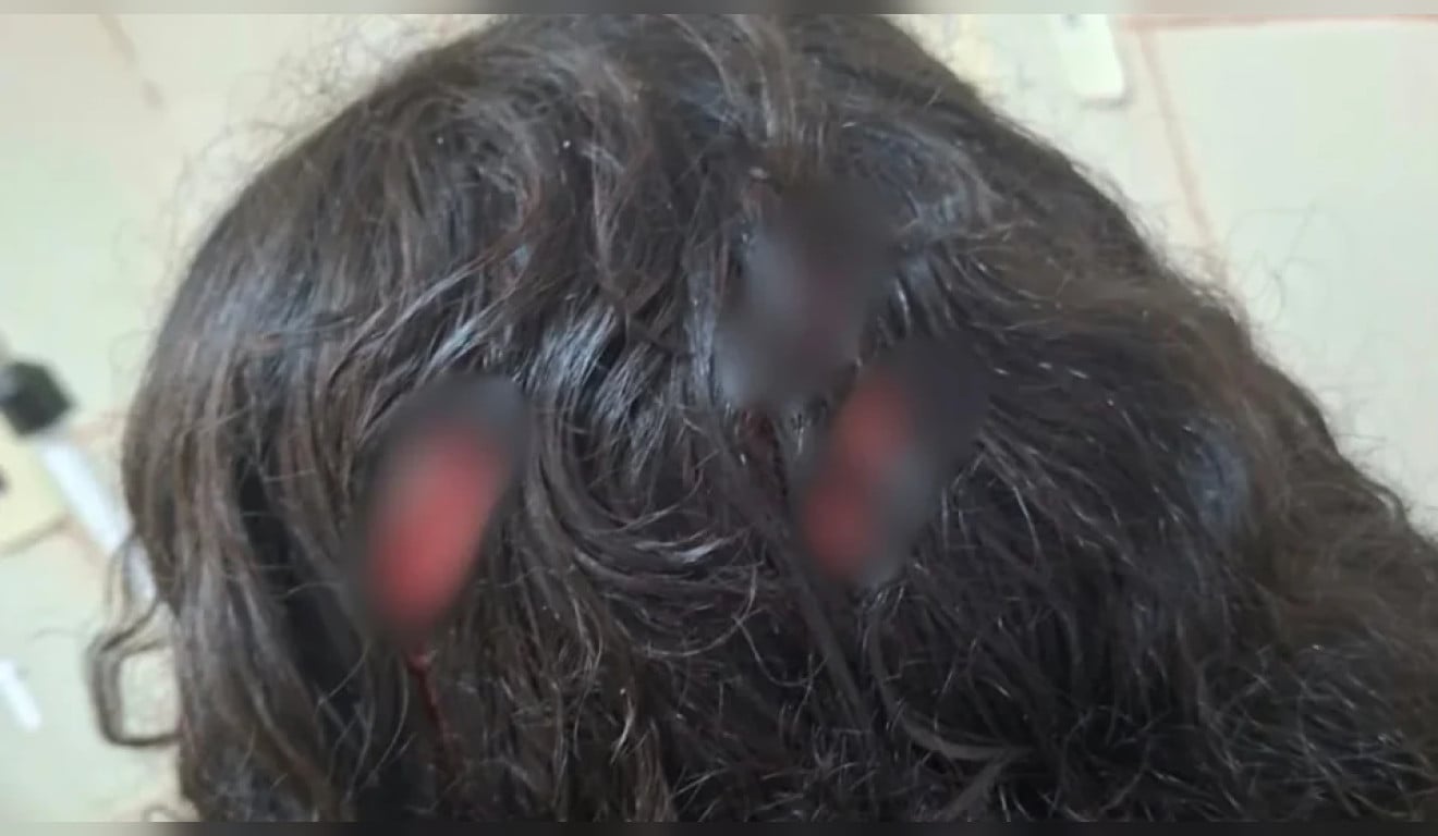 Estudante de 13 anos esfaqueia colega em escola de Belém; veja o que se sabe